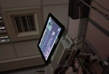 我在ICU里当个小公主-斯慕社